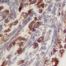 Cyr61/CCN1 antibody in Mouse Trigeminal Ganglia by Immunohistochemistry (IHC-Fr).