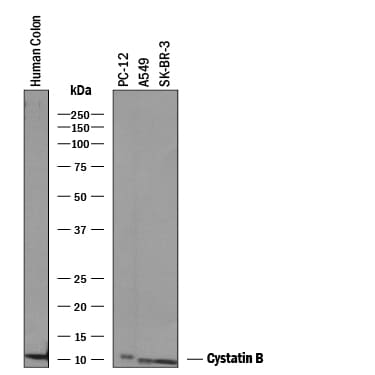 Detection of Human and Rat Cystatin B antibody by Western Blot.