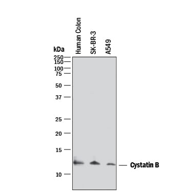 Detection of Human Cystatin B antibody by Western Blot.