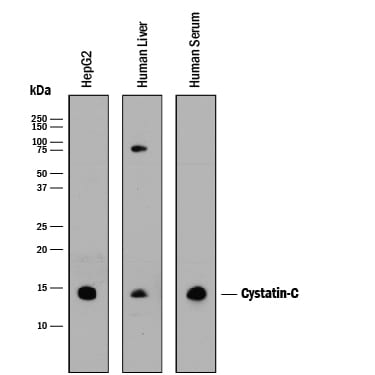 Detection of Human Cystatin C antibody by Western Blot.