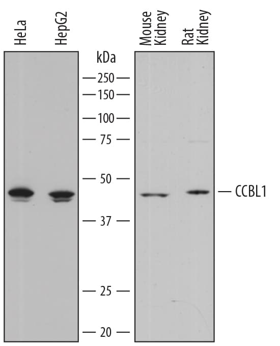 Detection of Human, Mouse, and Rat Cysteine Conjugate  beta -Lyase/CCBL1 antibody by Western Blot.