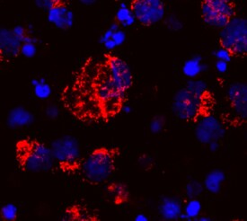 Cytochrome c antibody in Human PBMCs by Immunocytochemistry (ICC).
