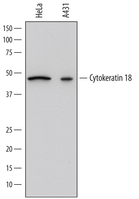 Detection of Human Cytokeratin 18 antibody by Western Blot.