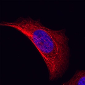 Cytokeratin 19 antibody in MCF-7 Human Cell Line by Immunocytochemistry (ICC).