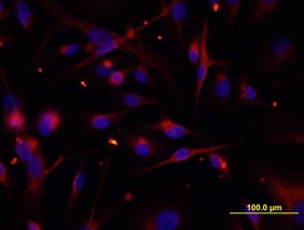 Cytokeratin 19 antibody in MDA-MB-231 Human Cell Line by Immunocytochemistry (ICC).