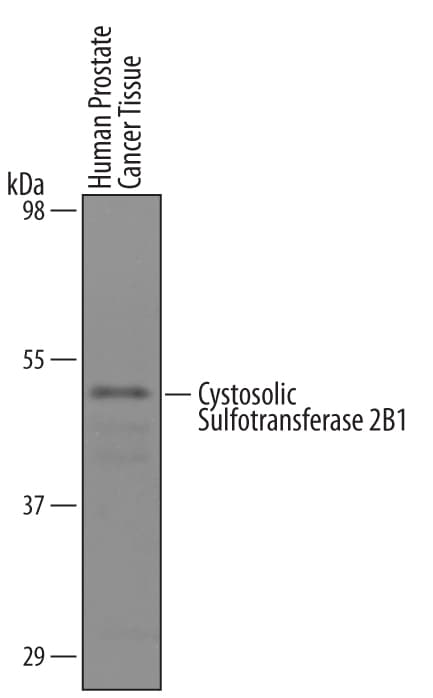 Detection of Human Cytosolic Sulfotransferase 2B1/SULT2B1 antibody by Western Blot.