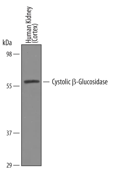 Detection of Human Cytosolic  beta -Glucosidase/GBA3 antibody by Western Blot