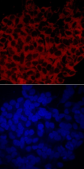 Cytosolic  beta -Glucosidase/GBA3 antibody in HeLa Human Cell Line by Immunocytochemistry (ICC).