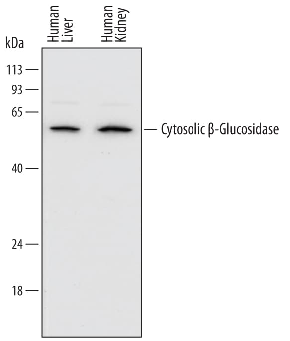 Detection of Human Cytosolic  beta -Glucosidase/GBA3 antibody by Western Blot.