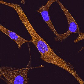 DAB2 antibody in A172 Human Cell Line by Immunocytochemistry (ICC).