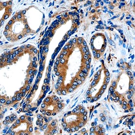 DAB2 antibody in Human Prostate by Immunohistochemistry (IHC-P).
