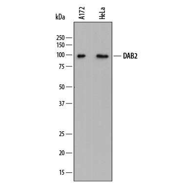 Detection of Human DAB2 antibody by Western Blot.
