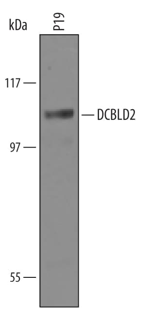 Detection of Mouse DCBLD2/ESDN antibody by Western Blot.