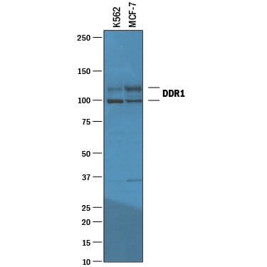 Detection of Human DDR1 antibody by Western Blot.