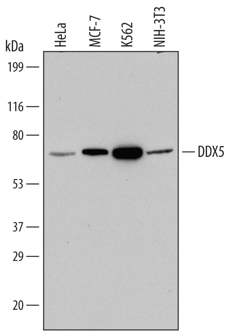 Detection of Human and Mouse DDX5 antibody by Western Blot.