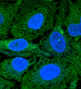 DFF40/CAD antibody in HeLa Human Cell Line by Immunocytochemistry (ICC).