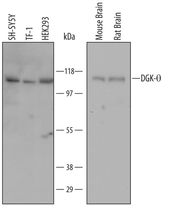 Detection of Human, Mouse, and Rat DGK-? antibody by Western Blot.