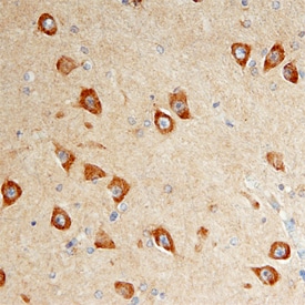 DISC1 antibody in Human Brain by Immunohistochemistry (IHC-P).