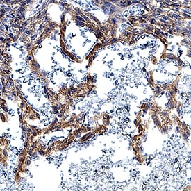 DLL4 antibody in Mouse Embryonic Heart by Immunohistochemistry (IHC-Fr).