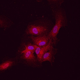DLL4 antibody in HUVEC Human Cells by Immunocytochemistry (ICC).