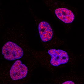 DNMT1 antibody in HeLa Human Cell Line by Immunocytochemistry (ICC).
