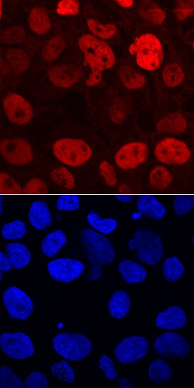 DNMT3B antibody in iPS2 Human Stem Cell Line by Immunocytochemistry (ICC).