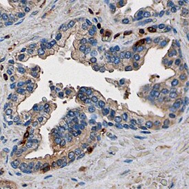 DNMT3B antibody in Human Colon by Immunohistochemistry (IHC-P).