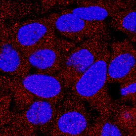DPP3 antibody in HeLa Human Cell Line by Immunocytochemistry (ICC).