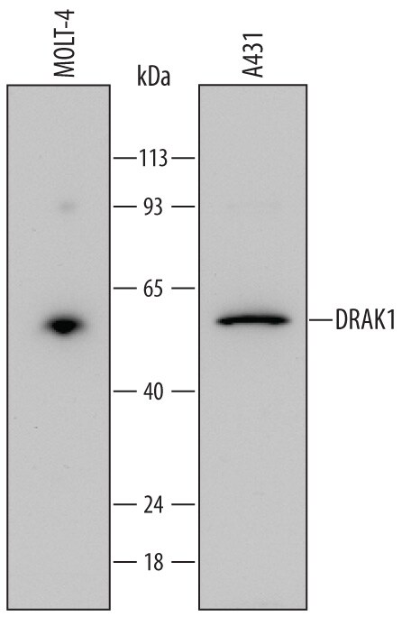 Detection of Human DRAK1 antibody by Western Blot.