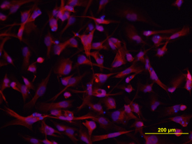 DSCAM antibody in A172 Human Cell Line by Immunocytochemistry (ICC).