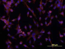 DSCAM antibody in A172 Human Cell Line by Immunocytochemistry (ICC).