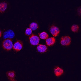 DTX1/DTX4 antibody in K562 Human Cell Line by Immunocytochemistry (ICC).