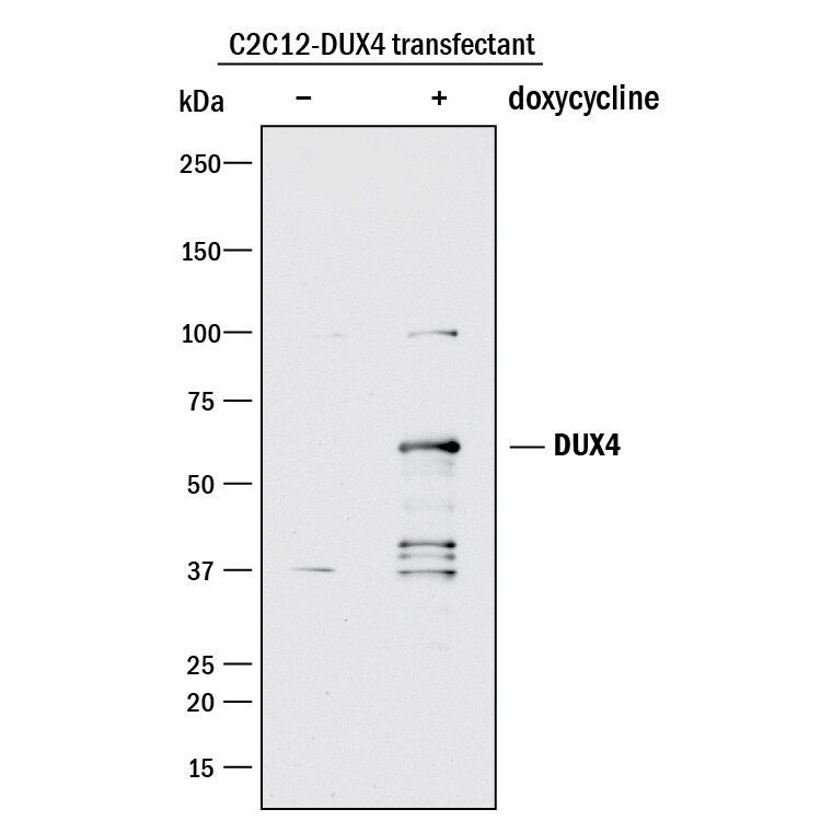Detection of Human DUX4 antibody by Western Blot.