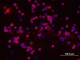DcTRAIL R1/TNFRSF23 antibody in Mouse Splenocytes by Immunocytochemistry (ICC).