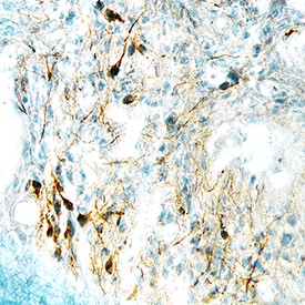 Desert Hedgehog/Dhh antibody in Mouse Brain by Immunohistochemistry (IHC-Fr).