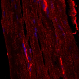 Desmin antibody in Mouse Skeletal Muscle by Immunohistochemistry (IHC-Fr).