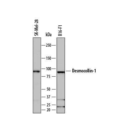 Detection of Human and Mouse Desmocollin-1 antibody by Western Blot.