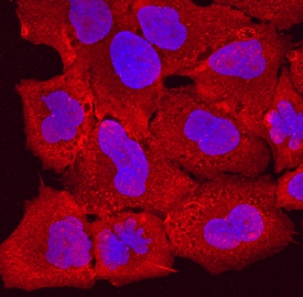 Desmocollin-1 antibody in A549 Human Cell Line by Immunocytochemistry (ICC).