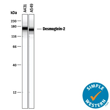 Detection of Human Desmoglein-2 antibody by Simple WesternTM.