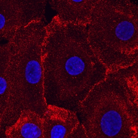 Desmoglein-2 antibody in NHEK Human Cells by Immunocytochemistry (ICC).