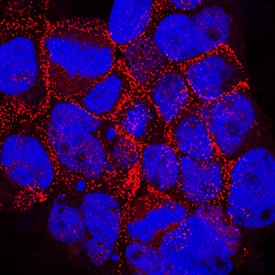 Desmoglein-2 antibody in A431 Human Cell Line by Immunocytochemistry (ICC).