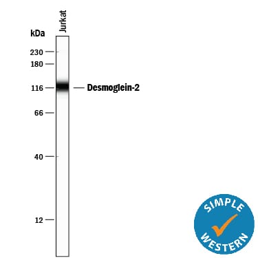Detection of Human Desmoglein‑2 antibody by Simple WesternTM.