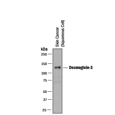 Detection of Human Desmoglein-3 antibody by Western Blot.