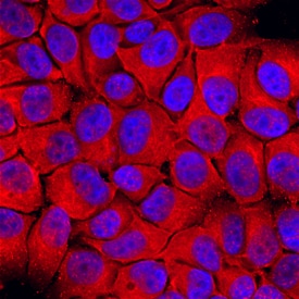 Dihydrofolate Reductase/DHFR antibody in MCF-7 Human Cell Line by Immunocytochemistry (ICC).