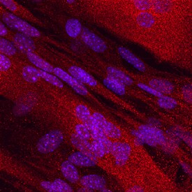 Dihydrofolate Reductase/DHFR antibody in C2C12 Mouse Cell Line by Immunocytochemistry (ICC).