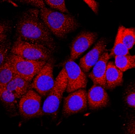 Dihydrofolate Reductase/DHFR antibody in MCF-7 Human Cell Line by Immunocytochemistry (ICC).
