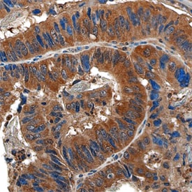 Dihydrofolate Reductase/DHFR antibody in Human Colon by Immunohistochemistry (IHC-P).