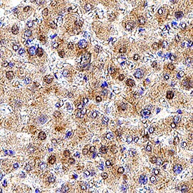 Dihydrolipoamide Dehydrogenase/DLD antibody in Human Liver Tissue by Immunohistochemistry (IHC-P).