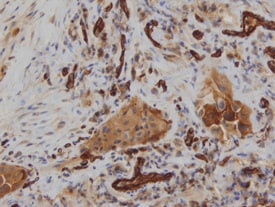 Dkk‑3 antibody in Human Lung by Immunohistochemistry (IHC-P).