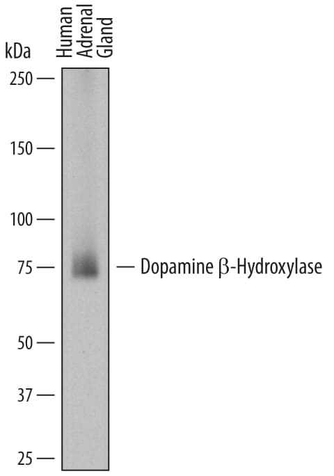 Detection of Human Dopamine  beta ‑Hydroxylase antibody by Western Blot.